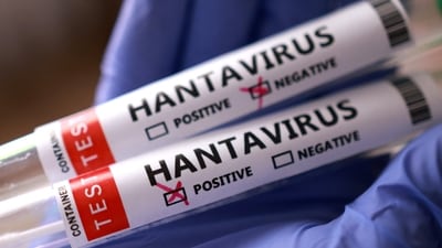 A confirmed hantavirus case has emerged among 17 Americans evacuated from a cruise ship, with another person showing mild symptoms. (REUTERS)