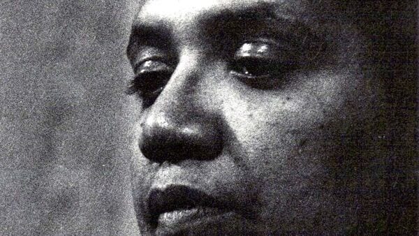 Audre Lorde’s powerful quote explains why self-acceptance is the first step toward living with purpose