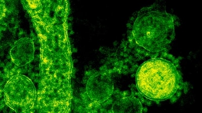 A third fatality from Legionnaires' disease has been confirmed in NYC, with 74 cases reported. (Pexel)