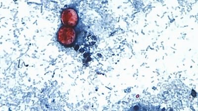 Cyclospora is a microscopic parasite that causes cyclosporiasis, an intestinal illness usually spread through contaminated fresh produce or water. (CDC via AP, File) (CDC via AP)